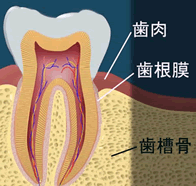 歯周病